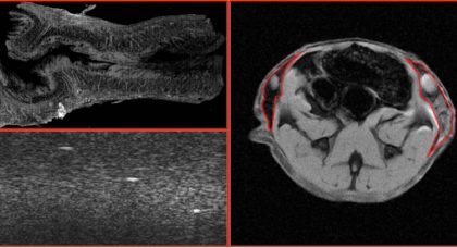 Collagen imaging: Bridging the gap between microscopy and the clinic