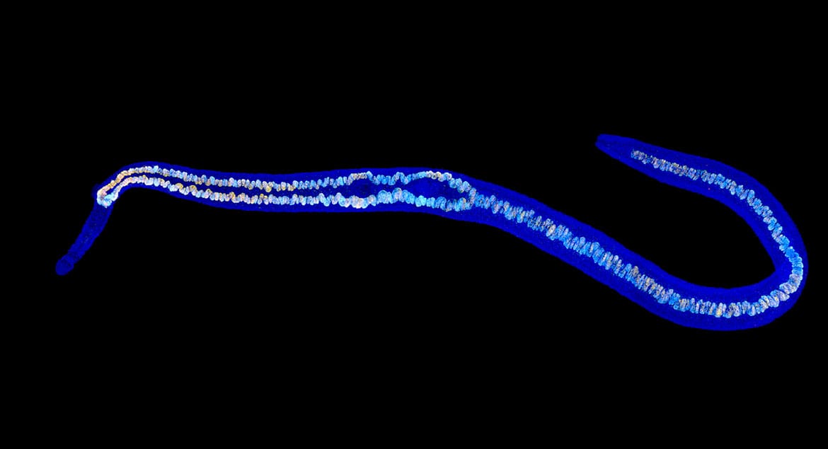 Schistosoma mansoni