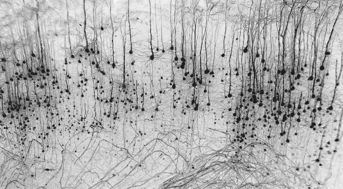 Neuronal forest – Marko Pende