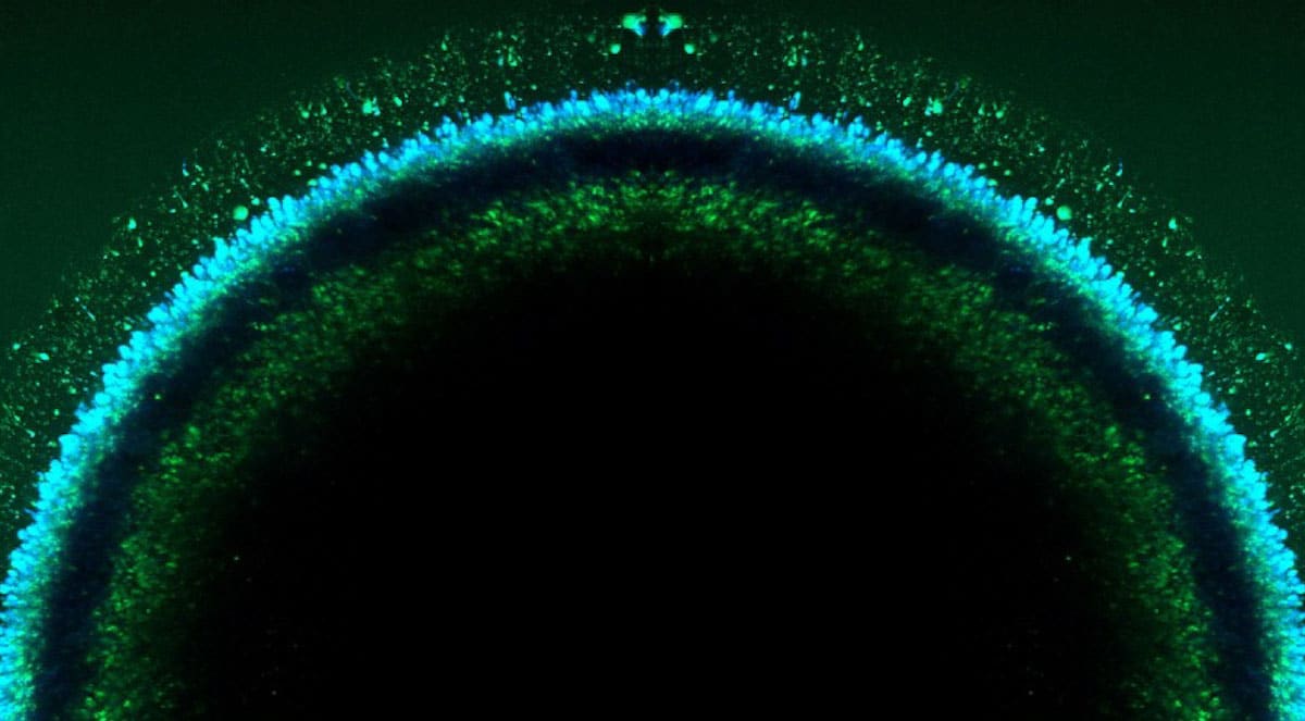 Retinal Organoids